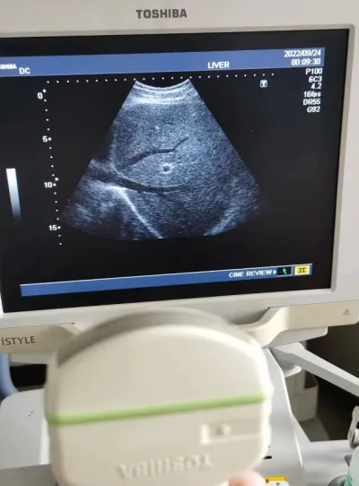 Sondes echographes philips siemens acuson aloka ge - Médical