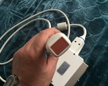 Sondes échographe occasion et neuf - photo 4